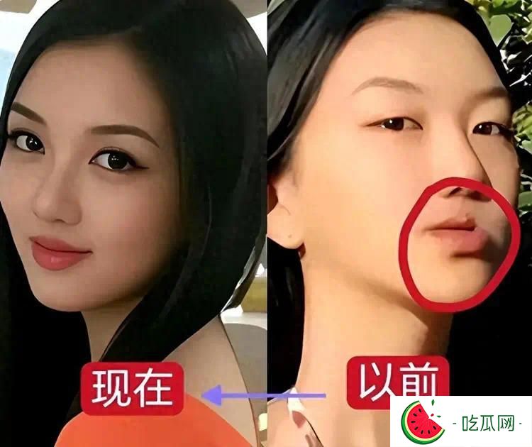 去掉兔唇后的李嫣驚為天人，果然，有王菲李亞鵬當(dāng)爸媽就是不一樣